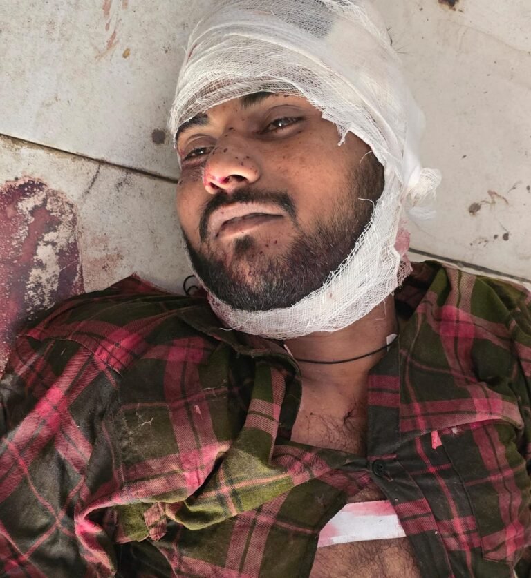डेढ़ लाख का इनामी बदमाश राजेश मुठभेड़ में ढेर, 50 से अधिक मुकदमे थे दर्ज