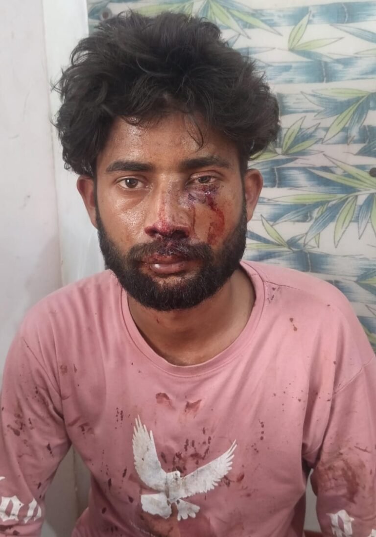 रामराज में गये युवक पर बाइक सवारों ने किया हमला, घायल