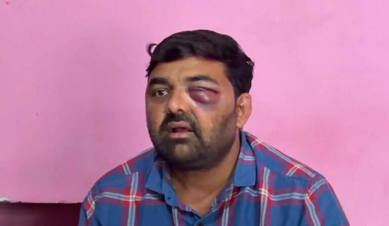 सपा नेताओं से मारपीट के आरोपों में 8 पुलिसकर्मी लाइन हाजिर, सिविल लाइंस इंस्पेक्टर भी हटे